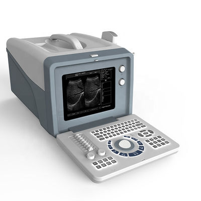 qualité  Ultrasound laptop diagnostic ultrasound machine /black and white ultrasound scanner with 15 inch LCD screen usine