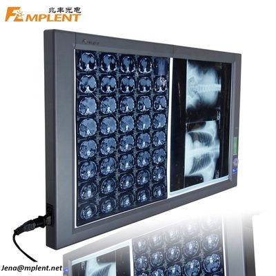 qualité  Super Bright Digital Dual General Film Medical Negatoscope LED X Ray Viewer usine