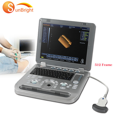 English Ultrasound Manufacturing New GE Ultrasound Machines Clear Portable 3D Imaging Laptop